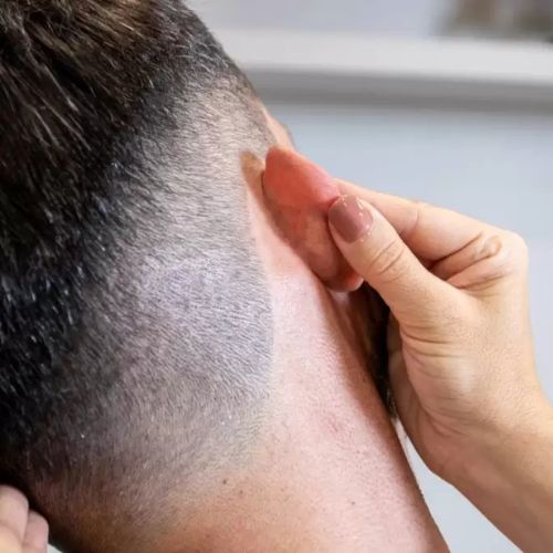 Otoplastia em Governador Valadares