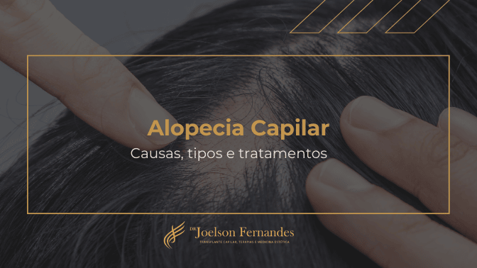 Alopecia capilar Causas, tipos e tratamentos