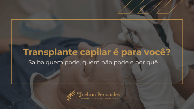 Transplante capilar é para você Saiba quem pode, quem não pode e por quê