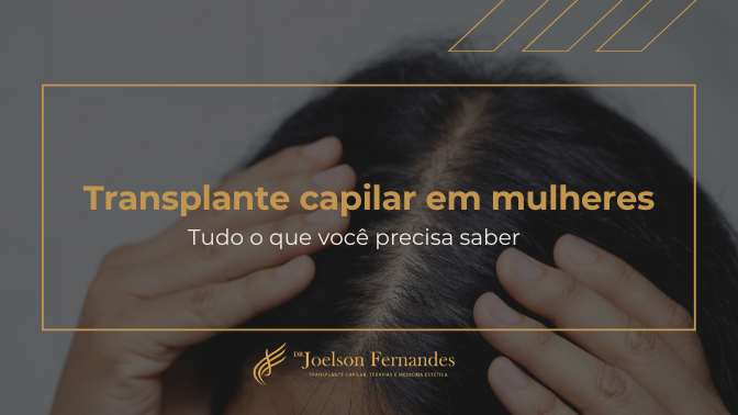 Transplante capilar em mulheres Tudo o que você precisa saber